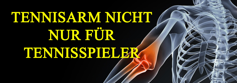 Ellenbogen Tendinitis banner 2